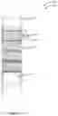 Fig. 06 - ADJUSTABLE LADDER AND STAIR SYSTEM
