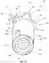 Fig. 10 - Percussion drill bit with at least one wear insert, related systems, and methods