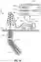 Fig. 02 - Systems and methods for holding wireline device against well