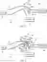 Fig. 05 - Particle separator