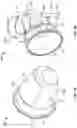 Fig. 02 - Limited flow thrust reverser actuating