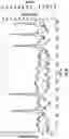 Fig. 07 - System and method for reducing loads of a wind turbine when a rotor blade becomes stuck