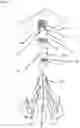 Fig. 06 - CEILING-FLUSH-MOUNTED STRUCTURAL HOLDER FOR TEMPORARY AND PERMANENT LIGHT FITTINGS