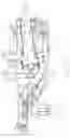 Fig. 04 - GAS TURBINE ENGINE COMBUSTOR WITH TAILORED TEMPERATURE PROFILE
