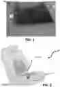 Fig. 02 - Heating and cooling technologies including temperature regulating pad wrap and technologies with liquid system