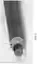 Fig. 06 - Firearm sound suppressor