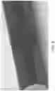 Fig. 07 - Firearm sound suppressor