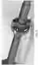 Fig. 09 - Firearm sound suppressor
