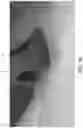 Fig. 15 - Firearm sound suppressor