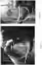 Fig. 03 - Transparent Projectile Proof Panels, Devices and Methods