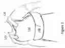 Fig. 05 - BODY ARMOR