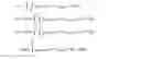 Fig. 04 - Methods and apparatus for determining shape parameter(s) using a sensing fiber having a single core with multiple light propagating modes