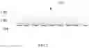 Fig. 03 - Blackbody radiation source