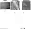 Fig. 25 - Method and apparatus for enhanced photo-thermal imaging and spectroscopy