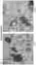 Fig. 18 - METHODS OF MEASURING EXOSOMES USING INTRINSIC FLUORESCENCE