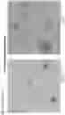 Fig. 19 - METHODS OF MEASURING EXOSOMES USING INTRINSIC FLUORESCENCE