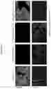 Fig. 12 - Compositions and methods for detecting protease activity in biological systems