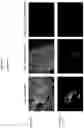 Fig. 20 - Compositions and methods for detecting protease activity in biological systems