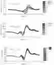 Fig. 06 - OPTICAL THERMAL METHOD AND SYSTEM FOR DIAGNOSING PATHOLOGIES