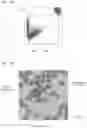 Fig. 13 - Blood analyzer and blood analyzing method for determining if plasmodium infection is present