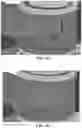 Fig. 12 - Methods and apparatus for patient positioning in magnetic resonance imaging