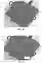Fig. 14 - Methods and apparatus for patient positioning in magnetic resonance imaging