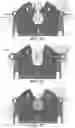 Fig. 15 - Methods and apparatus for patient positioning in magnetic resonance imaging