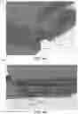 Fig. 16 - Methods and apparatus for patient positioning in magnetic resonance imaging