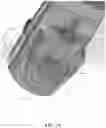 Fig. 17 - Methods and apparatus for patient positioning in magnetic resonance imaging