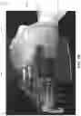 Fig. 22 - Methods and apparatus for patient positioning in magnetic resonance imaging