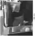 Fig. 28 - Methods and apparatus for patient positioning in magnetic resonance imaging