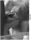 Fig. 31 - Methods and apparatus for patient positioning in magnetic resonance imaging
