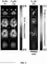 Fig. 05 - Multiband, multishot magnetic resonance elastography