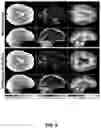 Fig. 06 - Multiband, multishot magnetic resonance elastography