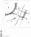 Fig. 16 - Interchangeable lens