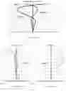 Fig. 06 - Camera lens