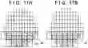 Fig. 15 - Method of manufacturing pattern and article manufacturing method