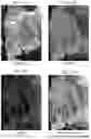 Fig. 17 - IMAGING APPARATUS, IMAGING SYSTEM, AND IMAGING METHOD