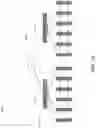 Fig. 11 - Determination of a response to a query