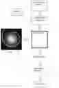 Fig. 01 - Sparse MRI data collection and classification using machine learning
