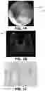 Fig. 02 - Negative sample enhanced object detection machine