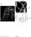 Fig. 06 - Hough transform-based vascular network disorder features on baseline fluorescein angiography scans predict response to anti-VEGF therapy in diabetic macular edema