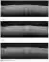 Fig. 06 - Compensating optical coherence tomography scans