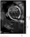 Fig. 07 - Image processing