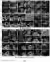 Fig. 08 - Image processing
