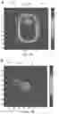 Fig. 02 - Correction of sharp-edge artifacts in differential phase contrast CT images and its improvement in automatic material identification