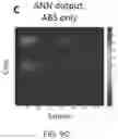 Fig. 19 - Correction of sharp-edge artifacts in differential phase contrast CT images and its improvement in automatic material identification