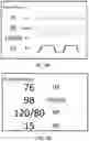 Fig. 04 - Systems and methods for adjusting medical device behavior
