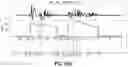 Fig. 12 - System providing expressive and emotive text-to-speech