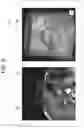 Fig. 07 - Medical image processing apparatus, medical image processing method and medical image processing system